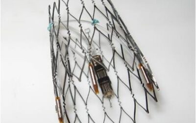 Researchers at Leonhardt Ventures Unveil E-Stent™ A Breakthrough Bioelectric Stimulation Stent Tech Platform