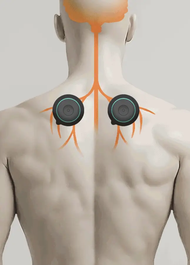 Chirp Halo Wireless Muscle Stim TENS Rapid Pain Relief