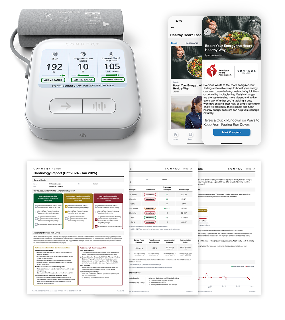 CONNEQT Pulse
