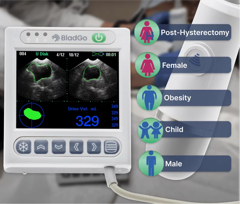 BladGo 2.0 Bladder Scanner