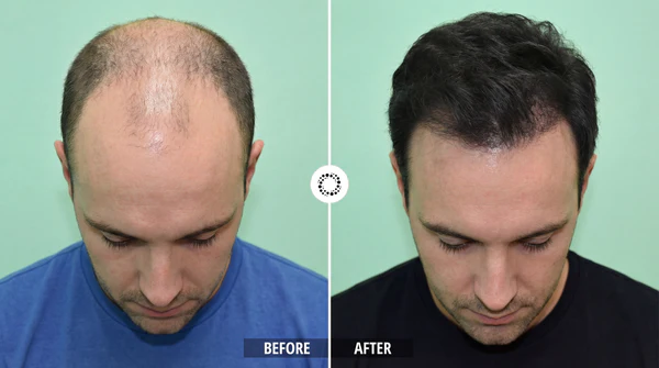 Cura Peptide Hair Growth Serum
