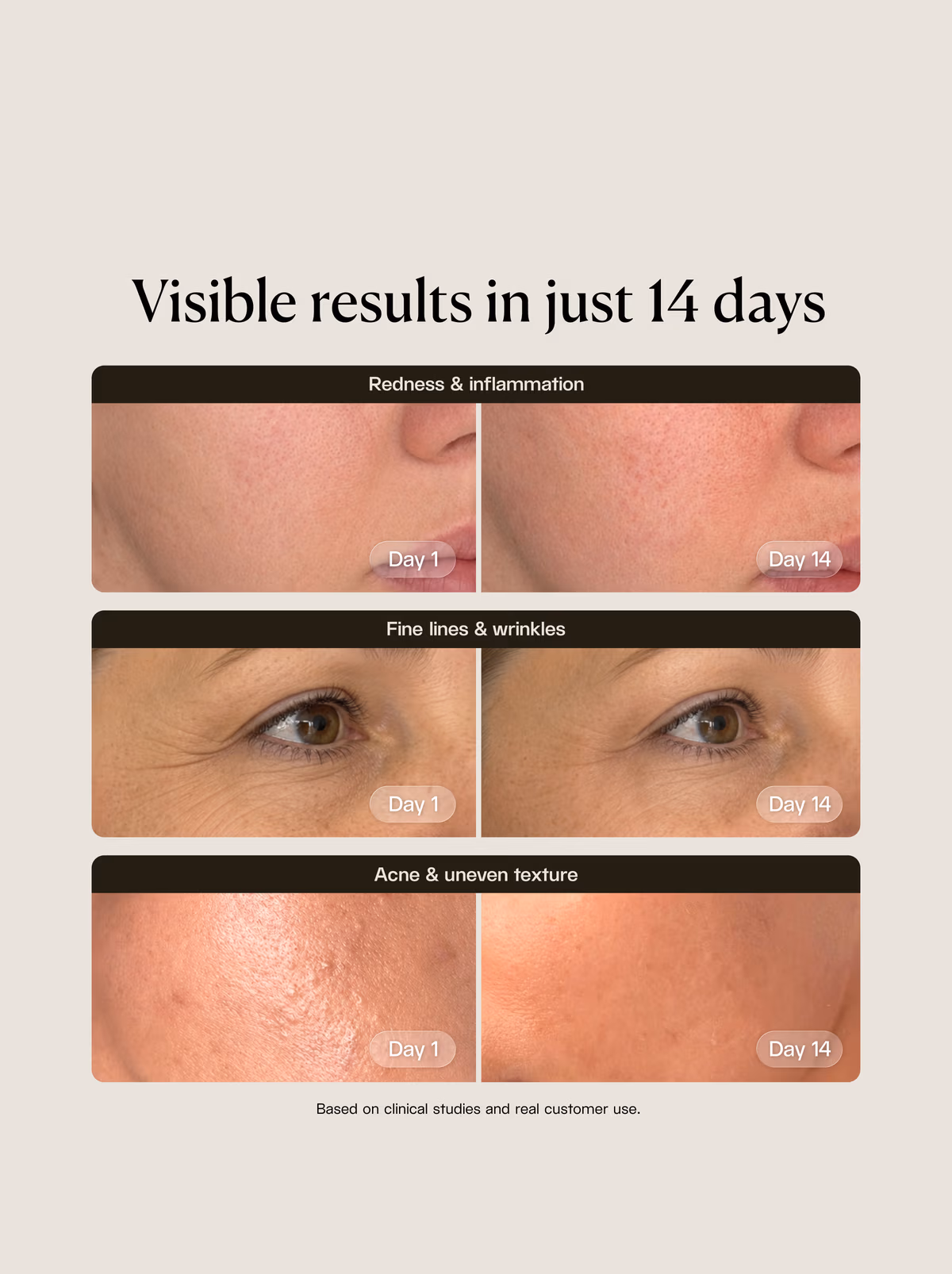 Erythros Laser Pro Mask