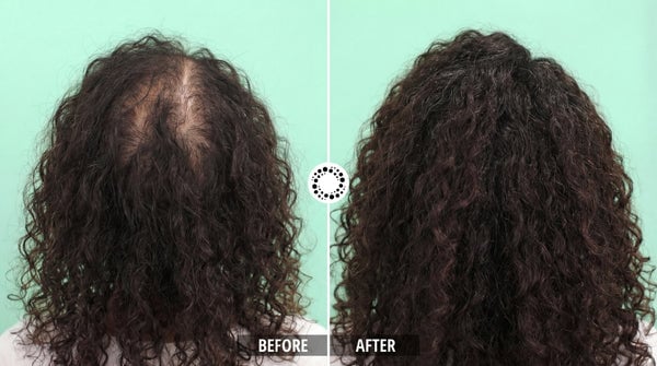 Cura Peptide Hair Growth Serum