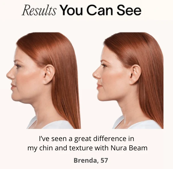 NuraSculpt Neck Wrap