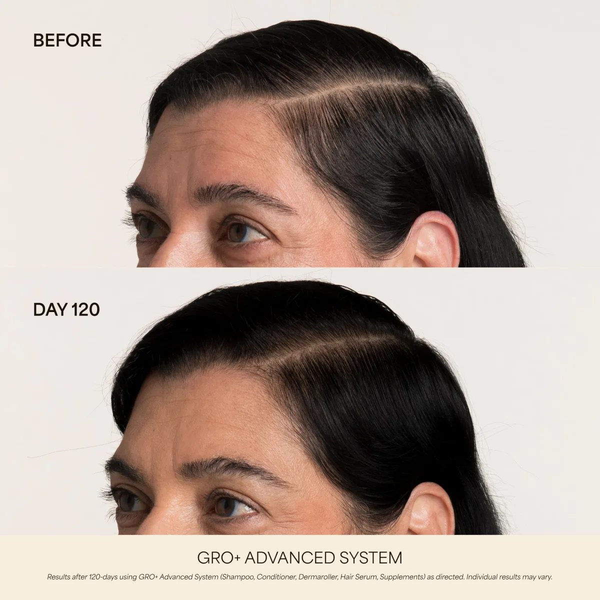 Vegamour GRO Hair Serum