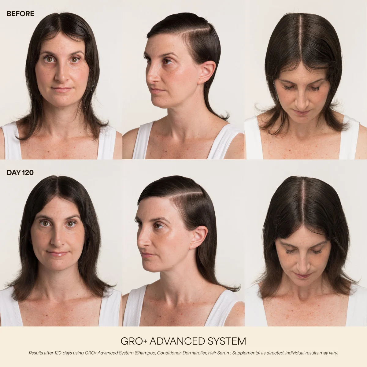 Vegamour GRO Hair Serum