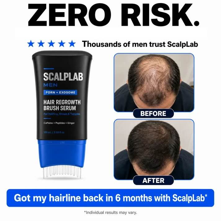 ScalpLab Hair Regrowth Brush Serum